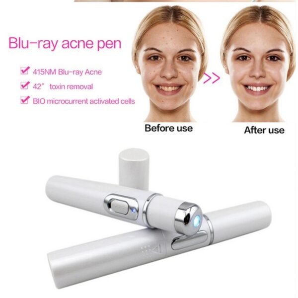 Blue Light Therapy Acne Laser Pen - Image 9